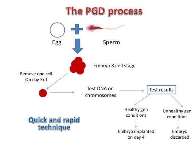 <strong>Why choose the PGD treatment in Delhi? </strong>