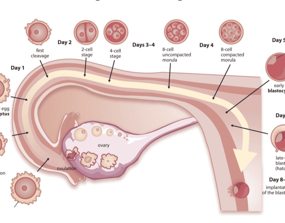 Endometrial Receptivity Array Test