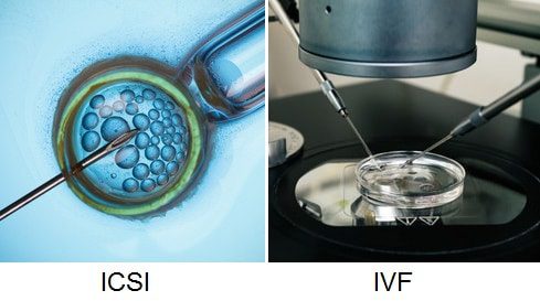 difference between IVF and ICSI