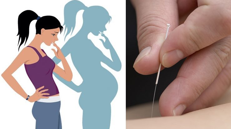 acupuncture and infertility