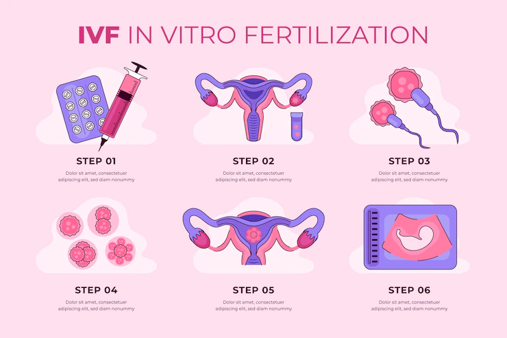 ivf cost in India, ivf process in India